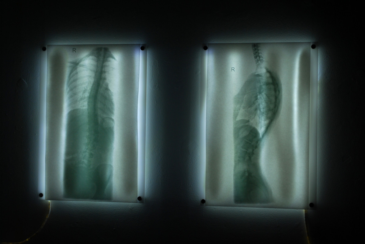 'Lumbarization', 2022; Silkscreen on Tashi Washi mounted on light boxes, 700 x 500mm